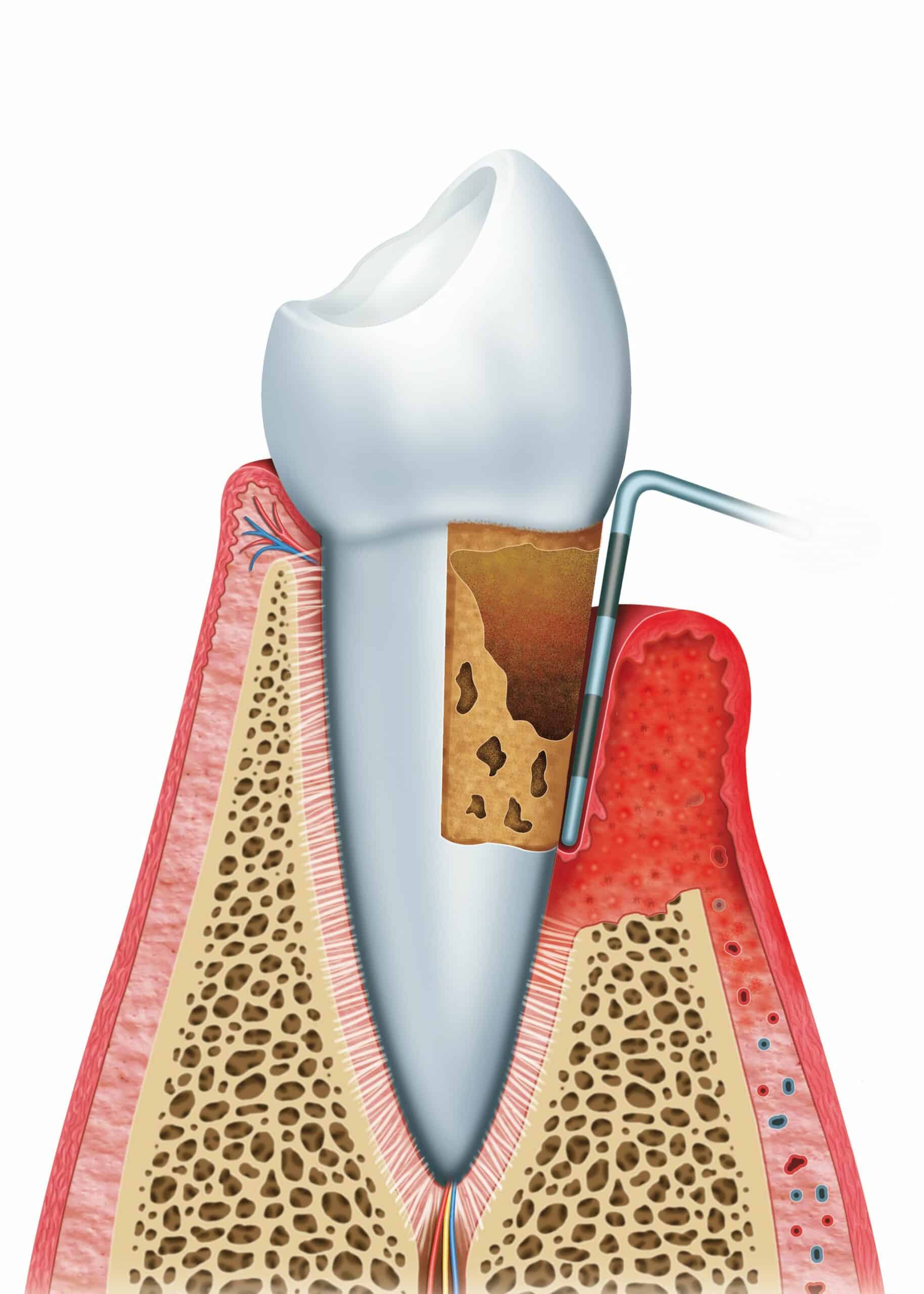 Periodontics Services in Nashville