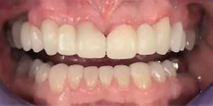original_CosmeticDentistry-After