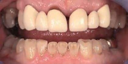original_CosmeticDentistry-Before