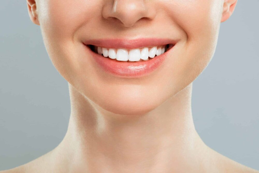 Teeth Whitening Nashville