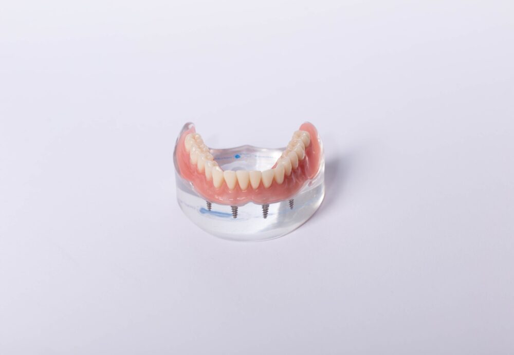 Implant-Supported Dentures Nashville